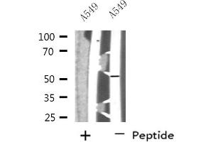 Western blot analysis of extracts from A549 cells, using NARFL antibody. (NARFL antibody  (Internal Region))