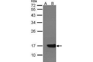 WB Image Western Blot analysis of CYB5A expression in transfected 293T cell line by CYB5A polyclonal antibody.