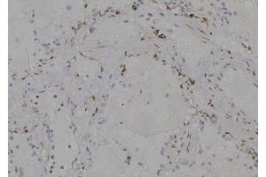 ABIN6277204 at 1/100 staining Human lung tissue by IHC-P.