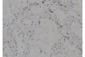 ABIN6277204 at 1/100 staining Human lung tissue by IHC-P. (Histone 3 antibody  (H3K79me))