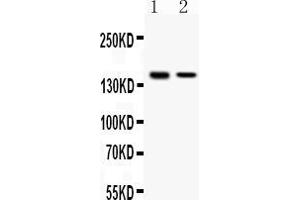 Western blot analysis of SAFB expression in HELA whole cell lysates ( Lane 1) and MCF-7 whole cell lysates ( Lane 2). (SAFB antibody  (C-Term))