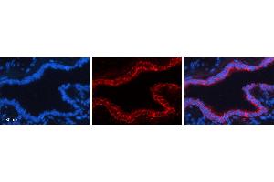 GCLC antibody - N-terminal region (ARP54576_P050) Catalog Number: ARP54576_P050  Formalin Fixed Paraffin Embedded Tissue: Human Bronchial Epithelial Tissue  Observed Staining: Cytoplasm and membrane of bronchial epithelial tissue Primary Antibody Concentration: 1:600  Secondary Antibody: Donkey anti-Rabbit-Cy3  Secondary Antibody Concentration: 1:200  Magnification: 20X  Exposure Time: 0. (GCLC antibody  (N-Term))