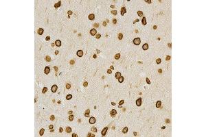 Immunohistochemistry of paraffin-embedded mouse brain using LMNA antibody at dilution of 1:200 (x400 lens). (Lamin A/C antibody  (AA 403-572))
