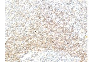 anti-Tumor Necrosis Factor Receptor Superfamily, Member 14 (TNFRSF14) (AA 39-200) antibody