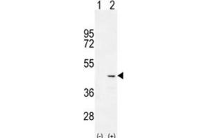Western Blotting (WB) image for anti-Cochlin (COCH) antibody (ABIN2996145) (COCH antibody)