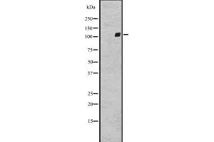 Western blot analysis of GPR64 expression in A431 whole cell lysate ,The lane on the left is treated with the antigen-specific peptide.