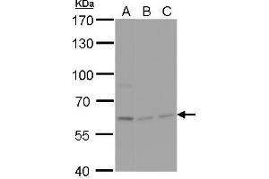 WB Image NPAS1 antibody detects NPAS1 protein by Western blot analysis.