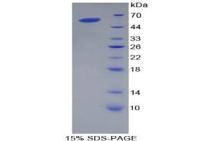 SDS-PAGE analysis of Pig Apolipoprotein A1 Protein. (APOA1 Protein)