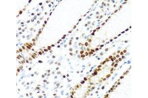 Immunohistochemistry of paraffin-embedded Human stomach using KHDRBS2 Polyclonal Antibody at dilution of 1:100 (40x lens). (KHDRBS2 antibody)