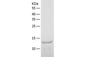Western Blotting (WB) image for Triggering Receptor Expressed On Myeloid Cells 2 (TREM2) (AA 19-161) protein (His tag) (ABIN7125494) (TREM2 Protein (AA 19-161) (His tag))