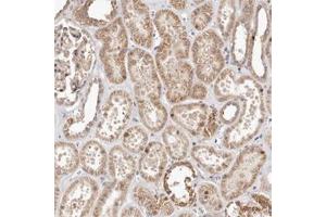 Immunohistochemical staining of human kidney shows moderate cytoplasmic positivity in tubular cells. (USP33 antibody)