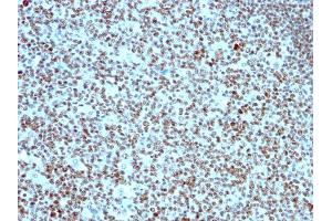 Formalin-fixed, paraffin-embedded human Tonsil stained with Nucleolin Monoclonal Antibody (SPM614). (Nucleolin antibody)