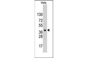 Western blot analysis of anti-HDGF Pab in Hela cell line lysates (35ug/lane). (HDGF antibody  (C-Term))