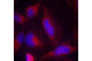 Immunofluorescence staining of methanol-fixed HeLa cells using FLT3 (Ab-591) Antibody (E021187, Red) (FLT3 antibody)