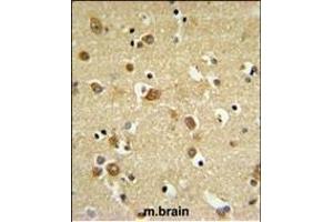 GABRD Antibody (Center) (ABIN653247 and ABIN2842772) IHC analysis in formalin fixed and paraffin embedded brain tissue followed by peroxidase conjugation of the secondary antibody and DAB staining. (GABRD antibody  (AA 331-358))