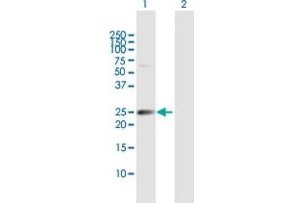 IGSF6 anticorps  (AA 1-241)