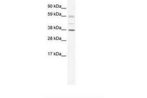 Image no. 1 for anti-SRY (Sex Determining Region Y)-Box 17 (SOX17) (AA 345-394) antibody (ABIN6735967) (SOX17 antibody  (AA 345-394))