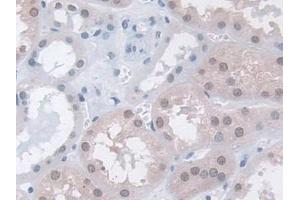 DAB staining on IHC-P; Samples: Human Kidney Tissue (MPP5 antibody  (AA 455-675))