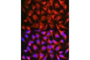 Immunofluorescence analysis of HeLa cells using [KO Validated] CD171/L1CAM Rabbit pAb (ABIN6131538, ABIN6143053, ABIN6143054 and ABIN7101826) at dilution of 1:150 (40x lens). (L1CAM antibody  (AA 1143-1257))