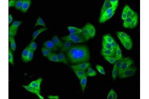Immunofluorescence staining of HepG2 cells with ABIN7164832 at 1:166, counter-stained with DAPI. (PCSK9 antibody  (AA 153-380))
