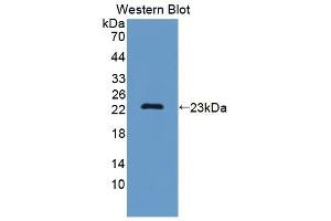 Detection of Recombinant SF3B3, Mouse using Polyclonal Antibody to Splicing Factor 3B Subunit 3 (SF3B3) (SF3B3 antibody  (AA 35-210))