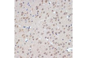 Immunohistochemistry of paraffin-embedded mouse brain using XPD/ERCC2 Rabbit mAb (ABIN7267057) at dilution of 1:100 (40x lens). (ERCC2 antibody)