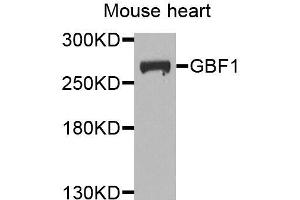 Western blot analysis of extracts of mouse heart, using GBF1 antibody (ABIN5974908) at 1/1000 dilution. (GBF1 antibody)