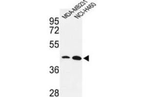 Western Blotting (WB) image for anti-Kruppel-Like Factor 4 (Gut) (KLF4) antibody (ABIN3001588) (KLF4 antibody)