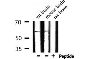 Western blot analysis of extracts from rat brain, mouse brain, using Phospho-Src (Tyr530) Antibody.