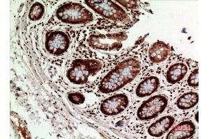 Immunohistochemistry (IHC) analysis of paraffin-embedded Human Colon, antibody was diluted at 1:100. (HLA-DQ1/DQ2 antibody  (Internal Region))