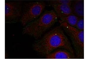 Image no. 1 for anti-Synuclein, alpha (SNCA) (pTyr125) antibody (ABIN401547) (SNCA antibody  (pTyr125))