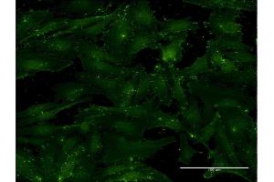 Immunofluorescence of monoclonal antibody to CD9 on HeLa cell. (CD9 antibody  (AA 112-195))