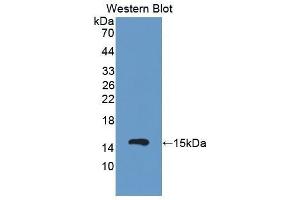 Western Blotting (WB) image for anti-Complement Factor B (CFB) (AA 474-590) antibody (ABIN3205632) (Complement Factor B antibody  (AA 474-590))