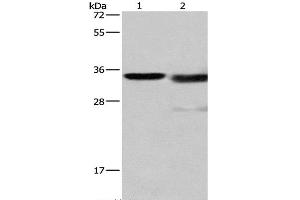Western Blot analysis of Mouse kidney tissue and A172 cell using Cathepsin L Polyclonal Antibody at dilution of 1:900 (Cathepsin L antibody)