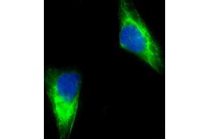 Immunofluorescent analysis of 4 % paraformaldehyde-fixed, 0. (MUT antibody  (AA 492-526))