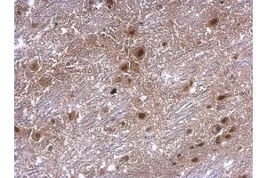 IHC-P Image axin 2 antibody [N2C2], Internal detects axin 2 protein at cytosol on mouse hind brain by immunohistochemical analysis. (AXIN2 antibody)