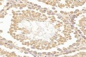 Immunohistochemistry analysis of paraffin-embedded mouse testis using,RHOBTB3 (ABIN7075422) at dilution of 1: 3600