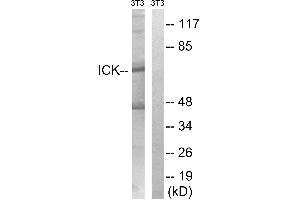 Western blot analysis of extracts from 3T3 cells, treated with PBS (10uM, 60mins), using ICK (Ab-159) antibody. (JAK3 antibody  (Tyr159))