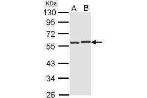 WB Image Sample (30 ug of whole cell lysate) A: Hep G2 , B: Raji 10% SDS PAGE antibody diluted at 1:1000 (CAP1 antibody  (Center))