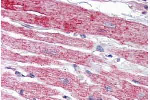 Human Heart (formalin-fixed, paraffin-embedded) stained with NPTX2 antibody ABIN343900 at 5 ug/ml followed by biotinylated goat anti-rabbit IgG secondary antibody ABIN481713, alkaline phosphatase-streptavidin and chromogen. (NPTX2 antibody  (Internal Region))