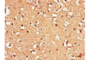 Immunohistochemistry of paraffin-embedded human brain tissue using ABIN7159432 at dilution of 1:100 (Metabotropic Glutamate Receptor 1 antibody  (AA 880-1017))