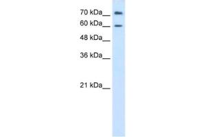 Western Blotting (WB) image for anti-Proline Dehydrogenase (Oxidase) 2 (PRODH2) antibody (ABIN2462440) (PRODH2 antibody)