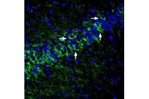 Expression of KCNK12  in rat hippocampusImmunohistochemical staining of perfusion-fixed frozen rat brain sections with Anti-KCNK12  (extracellular) Antibody (ABIN7043449, ABIN7045070 and ABIN7045071), (1:400), followed by goat anti-rabbit-AlexaFluor-488 secondary antibody.