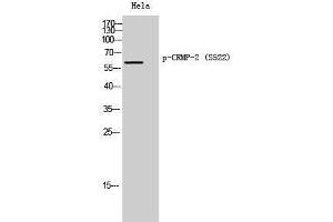Western Blotting (WB) image for anti-Dihydropyrimidinase-Like 2 (DPYSL2) (pSer522) antibody (ABIN3173158) (DPYSL2 antibody  (pSer522))