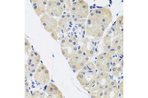 Immunohistochemistry of paraffin-embedded human stomach using ALAD antibody (ABIN5974581) at dilution of 1/100 (40x lens). (ALAD antibody)