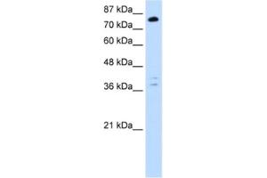 Western Blotting (WB) image for anti-TSC22 Domain Family, Member 2 (TSC22D2) antibody (ABIN2461857) (TSC22D2 antibody)
