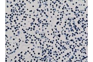 ICC staining of human HepG2 cells with recombinant H3K79me2 antibody. (Recombinant Histone 3 antibody  (H3K79me2))