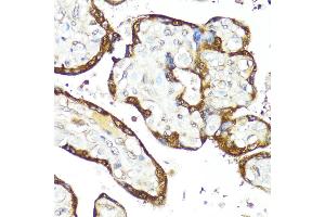 Immunohistochemistry of paraffin-embedded Human placenta using IFN antibody (ABIN3015562, ABIN3015563, ABIN3015564 and ABIN6218872) at dilution of 1:100 (40x lens). (IFNAR2 antibody  (AA 27-243))