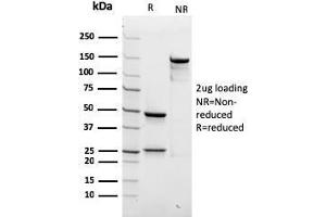 SDS-PAGE Analysis Purified SPTBN2 Recombinant Mouse Monoclonal Antibody (rSPTBN2/1778). (Recombinant Spectrin, Beta, Non-erythrocytic 2 (SPTBN2) (AA 356-475) antibody)