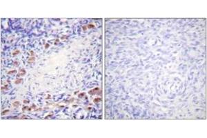 Immunohistochemistry analysis of paraffin-embedded human ovary tissue, using Daxx (Ab-668) Antibody. (DAXX antibody  (AA 634-683))